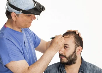 کاشت مو به روش FUG