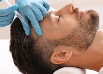 مزوتراپی مو