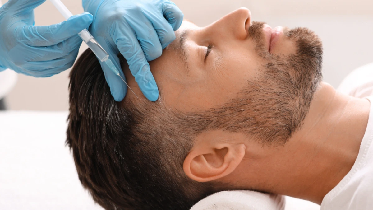 مزوتراپی مو