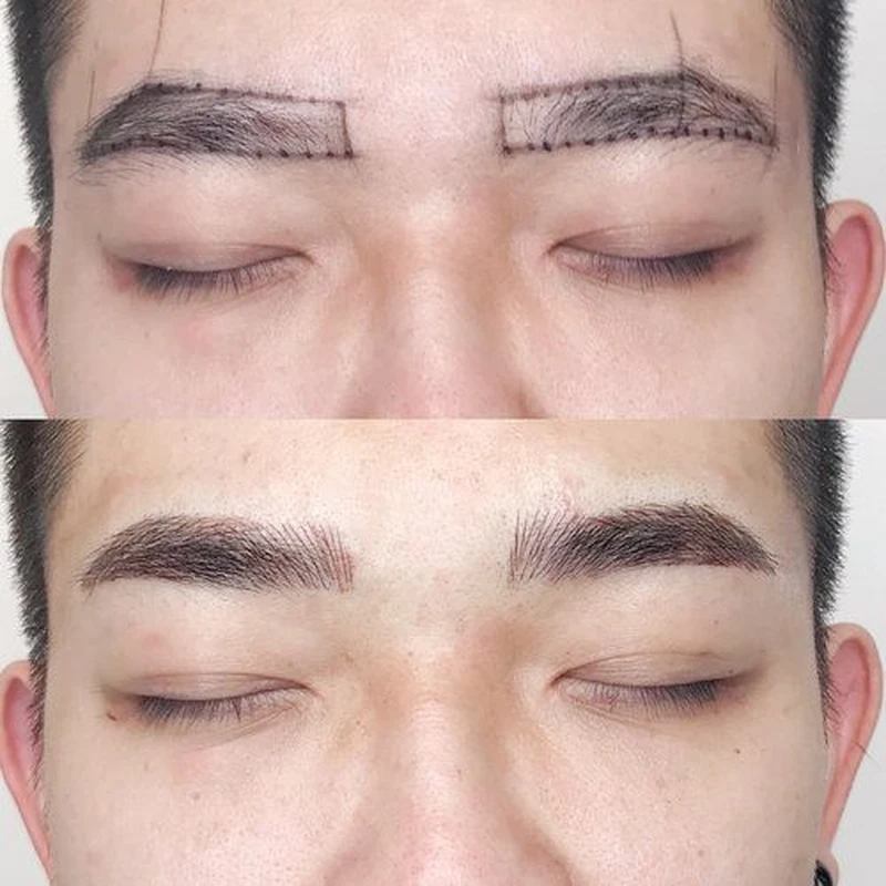 میکروبلیدینگ ابرو