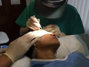 بهترین دکتر کاشت ابرو تهران