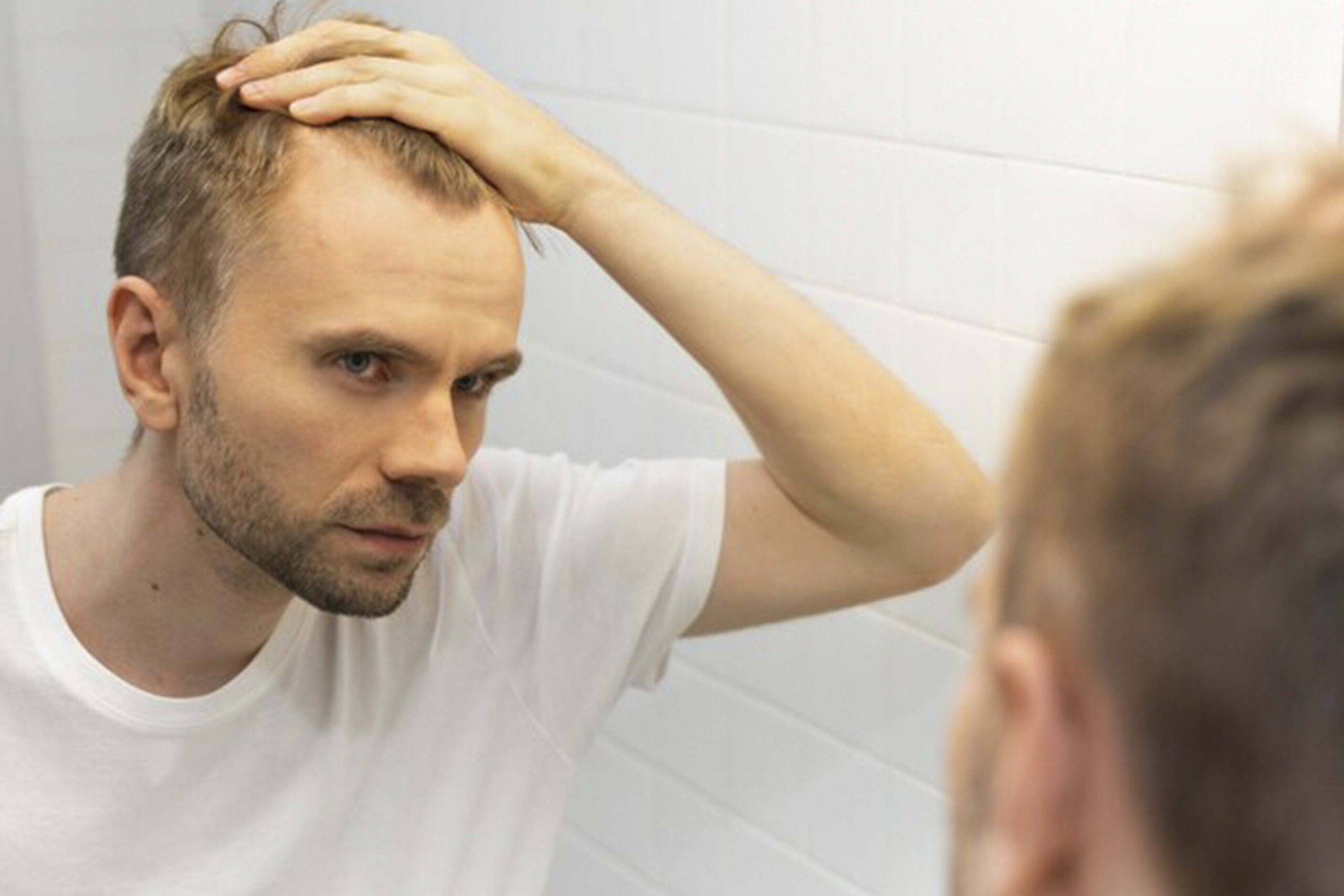 درمان ریزش مو ناشی از استرس+دلایل وعلائم آن