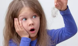 ریزش مو کودکان