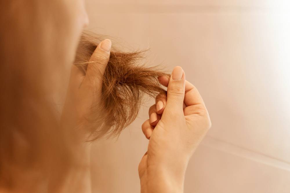 ریزش موی ارثی (آندروژنیک) چیست؟