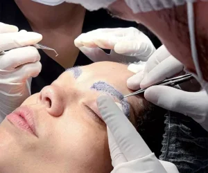 مراقبت های قبل از کاشت ابرو