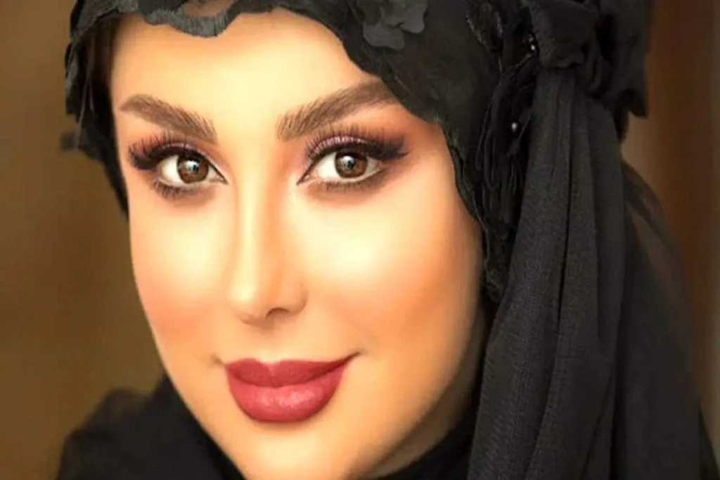 کاشت ابرو نیوشا ضیغمی