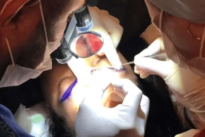 کاشت ابرو چقدر زمان میبرد