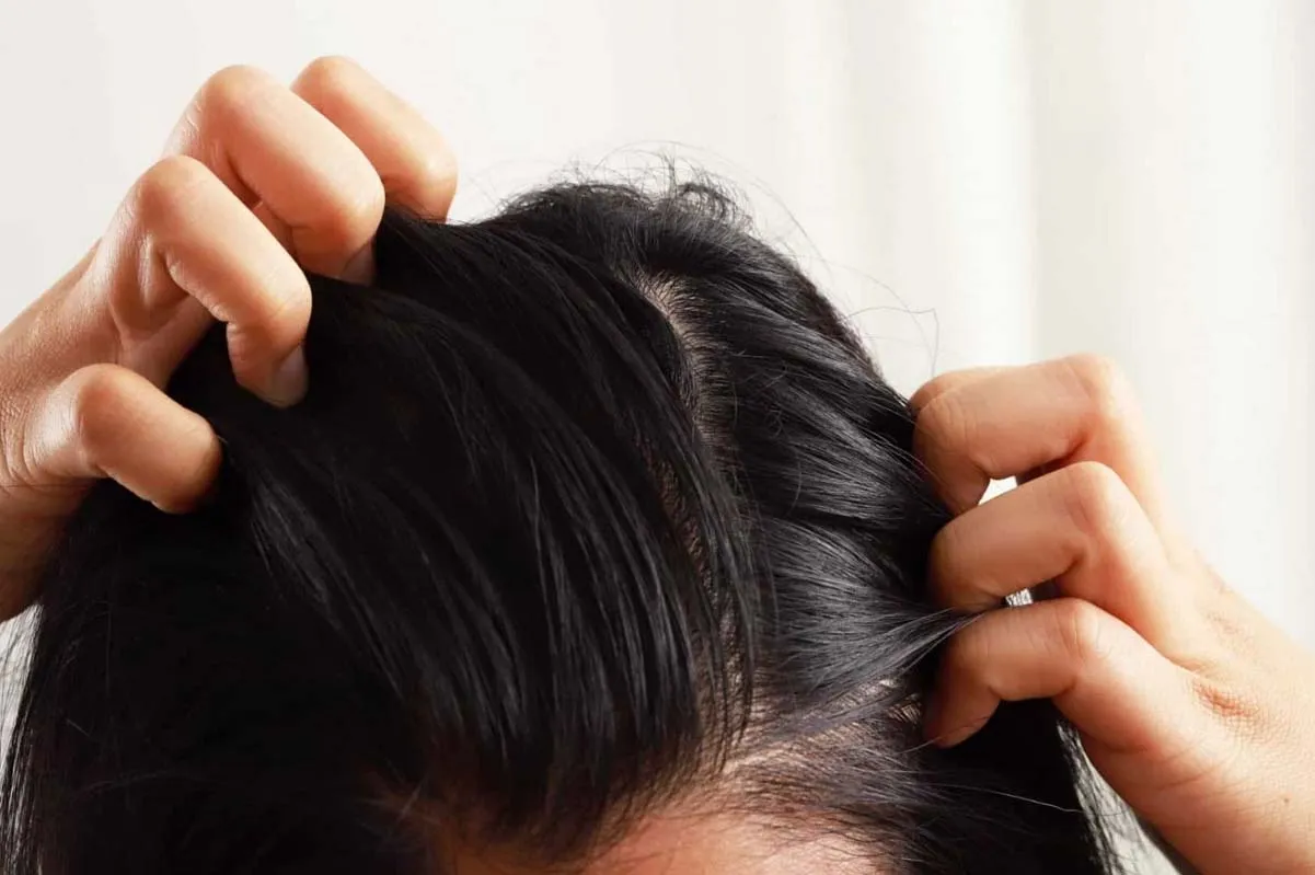روش هایی موثر و ماندگار برای جلوگیری از ریزش مو طبق تحقیقات