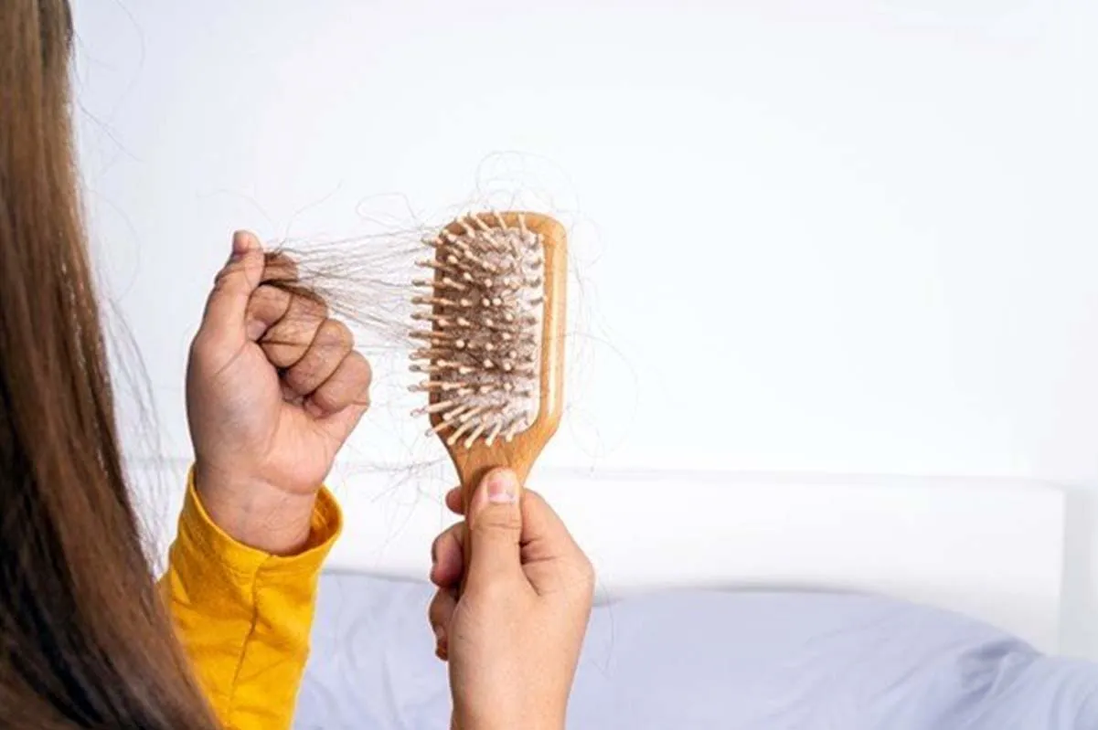 عوامل موثر در ریززش مو