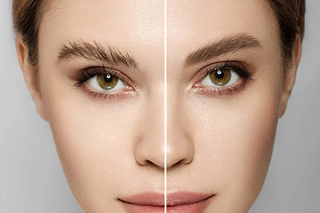 میکروبلیدینگ یا کاشت ابرو