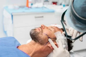 کاشت ریش به روش fut