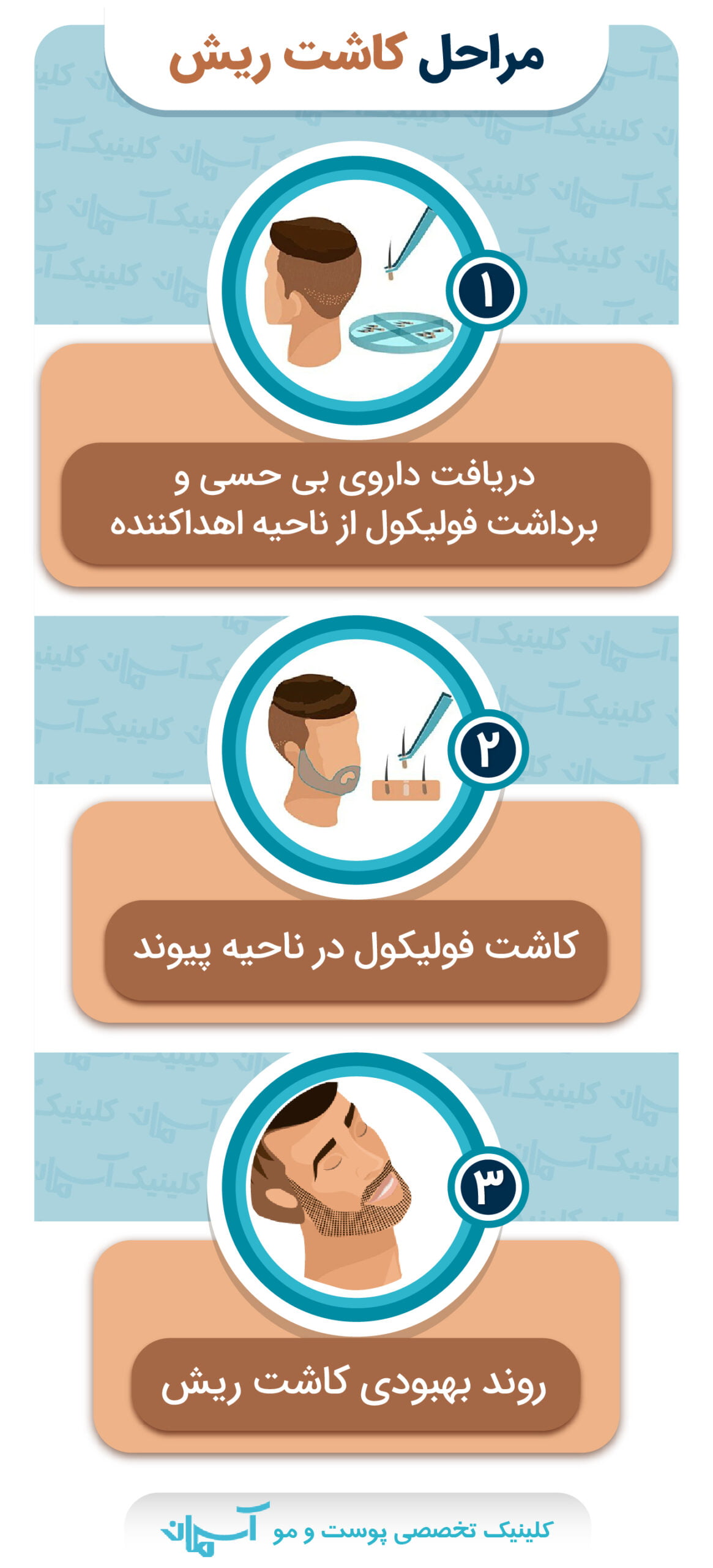 مراحل کاشت ریش