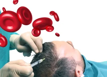 سلول مو و روش های سلول درمانی مو