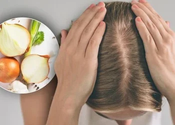 درمان ریزش مو با آب پیاز